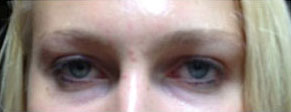 Before image of two sets of eyes, close ups of women pictured above.