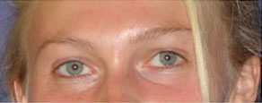 After image of two sets of eyes, close ups of women pictured above.